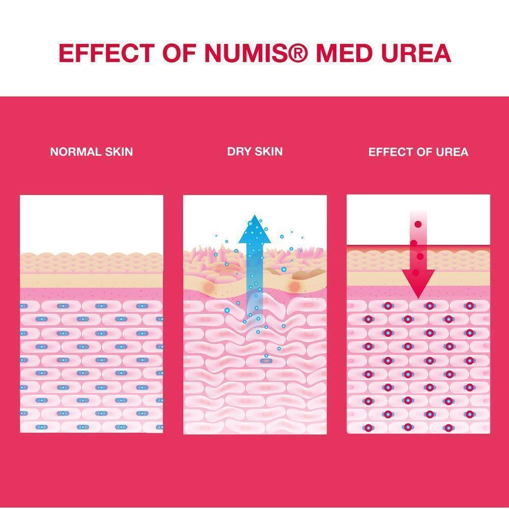 numis med UREA 25% chapped skin ointment, 50 ml